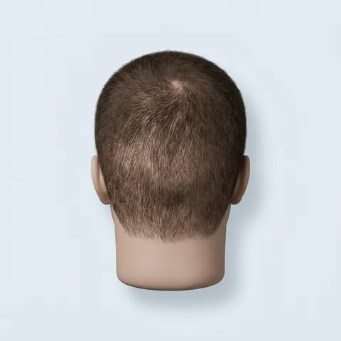 Back of the head with average donor hair