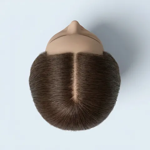Top view: a high hairline