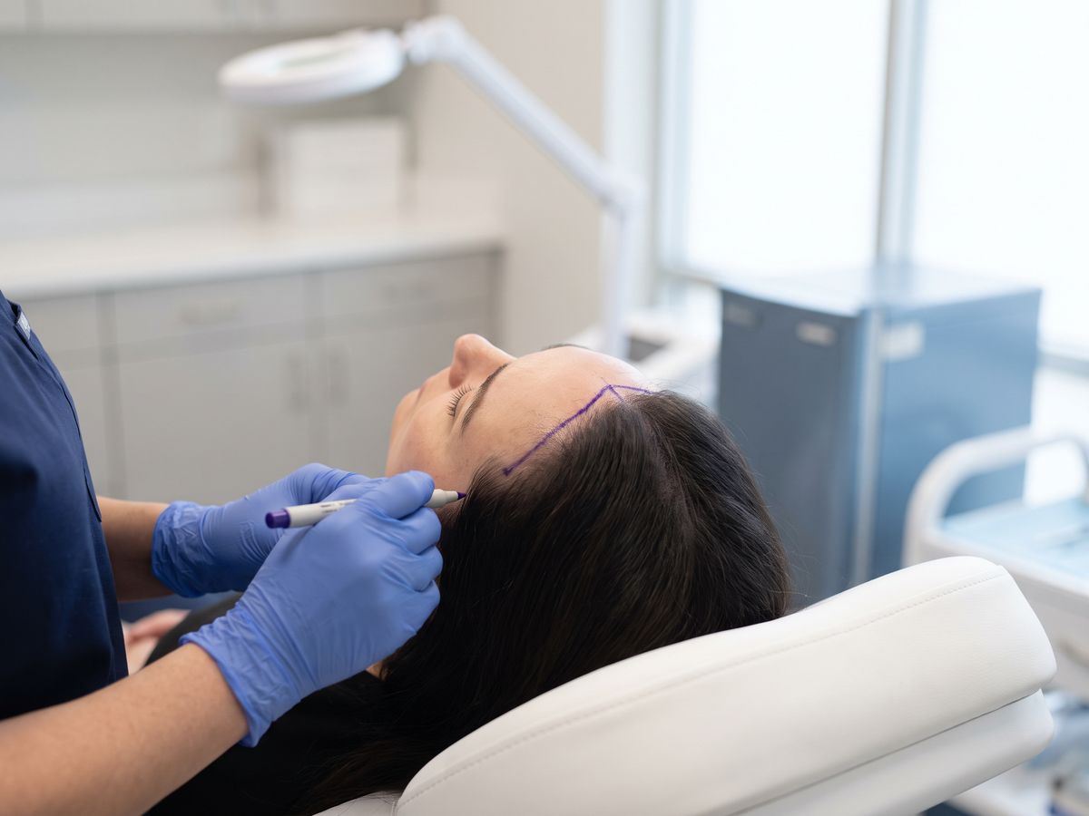 Hairline design with a clinical skin marker