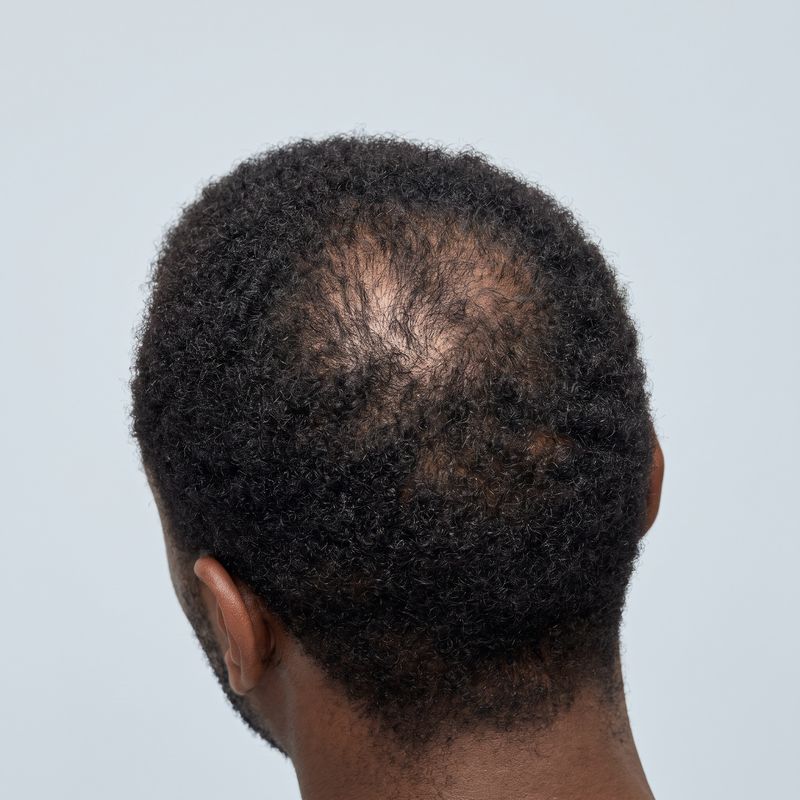 Crown thinning