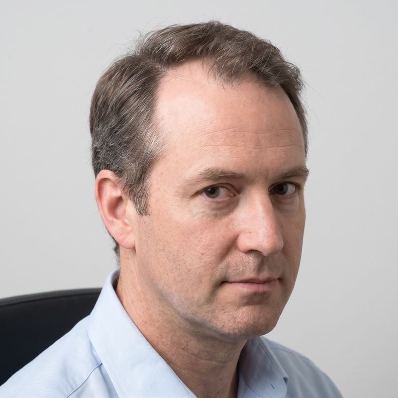 Receding hairline