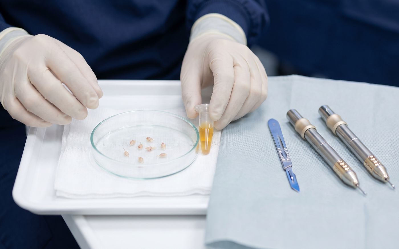 PRP plasma tube, follicular grafts, and hair transplant tools on sterile tray