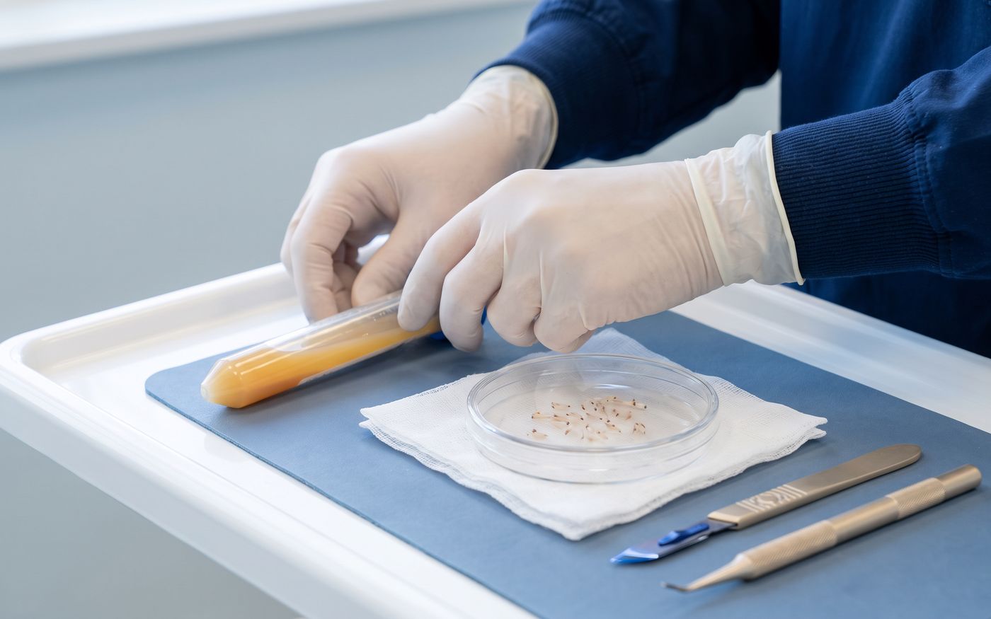 PRP tube, follicular grafts, and sapphire blade prepared on a white tray